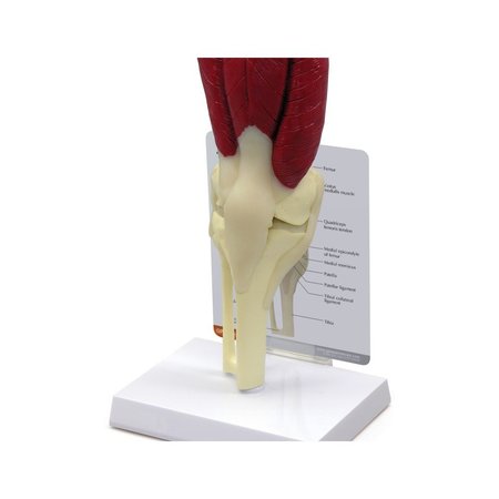 GPI ANATOMICAL Anatomical Model - Muscled Knee 1060